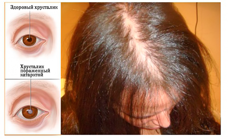 7 главных признаков дефицита витамина Е, которые вы никогда не должны игнорировать!